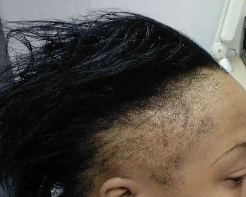 Top 10 reasons your edges are thinning and breaking